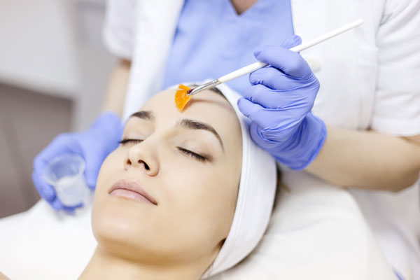 Medical Grade Peel treatment in Chester