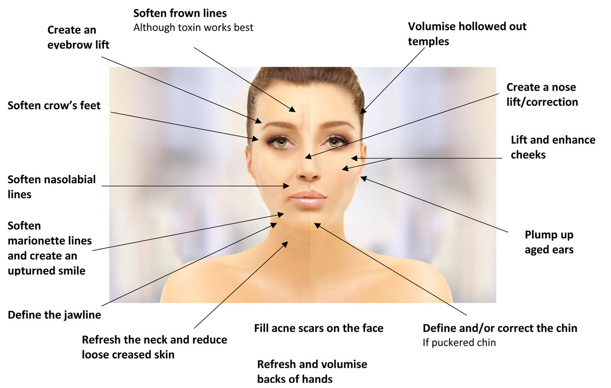 biostimulators