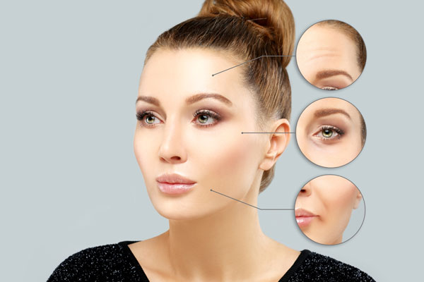 Dermal HA Fillers