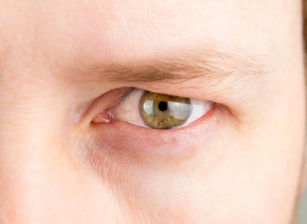 Would you like some treatments for tired, sunken or dark eyes?