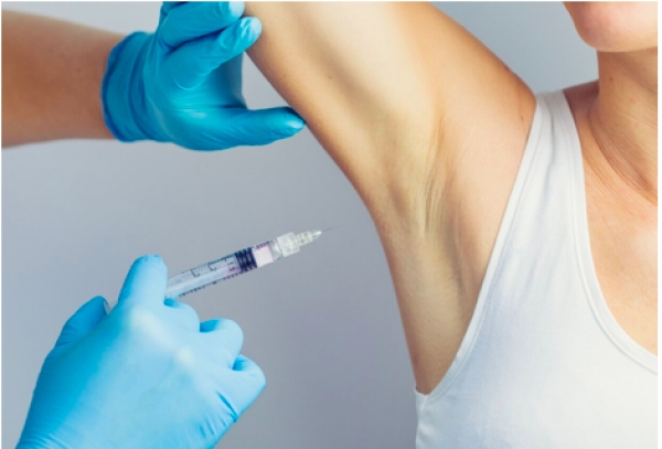 Botox for excess sweating (hyperhidrosis)