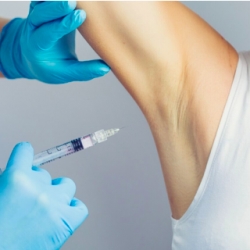 Botox for excess sweating (hyperhidrosis)