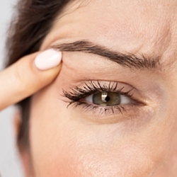 Drooping eyelids. What works and what doesn’t.